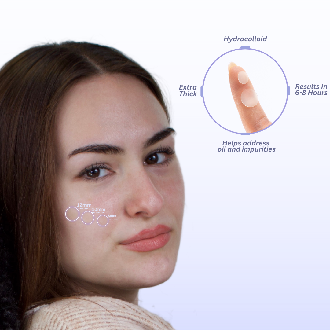 Maskeraide - Hydrocolloid Acne Patches – Overnight Blemish Treatment
